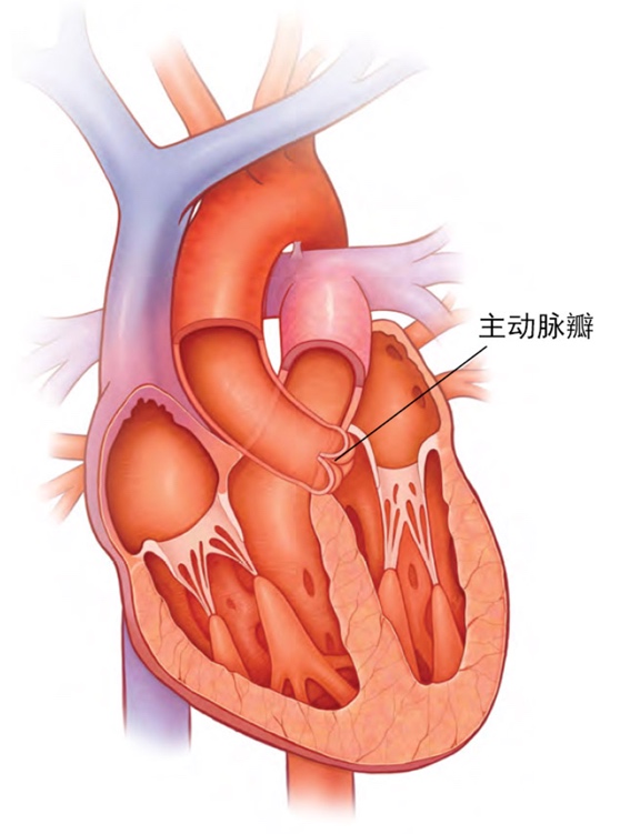 阜外tavr俱乐部瓣膜病患者温暖的家