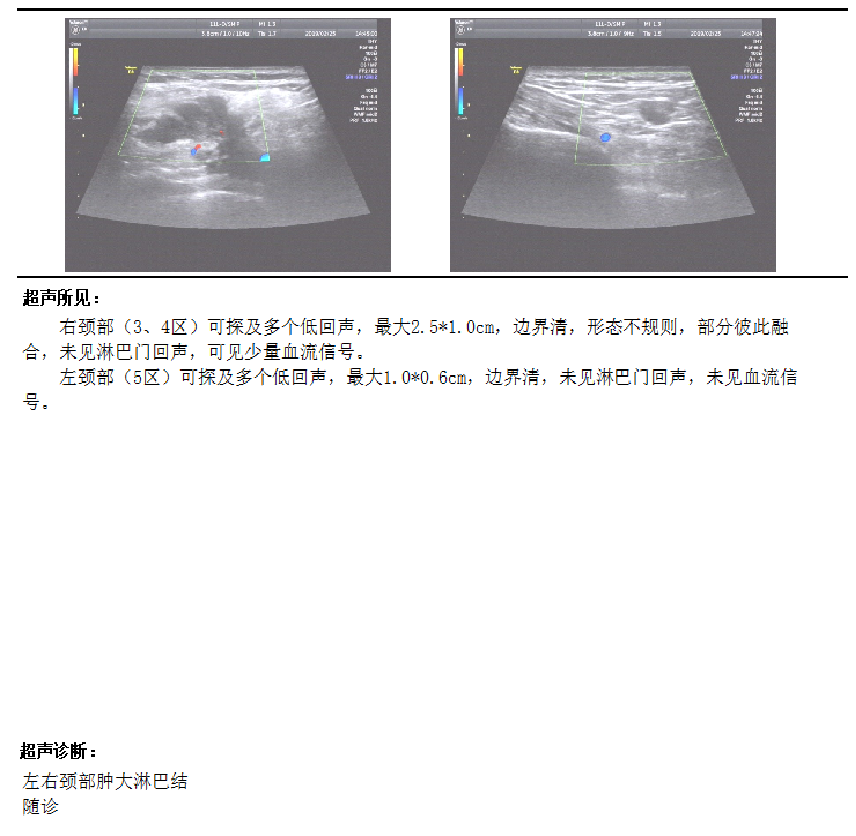 晚期乳腺癌内分泌诊疗病例征集——大连医科大学附属第二医院,李娜