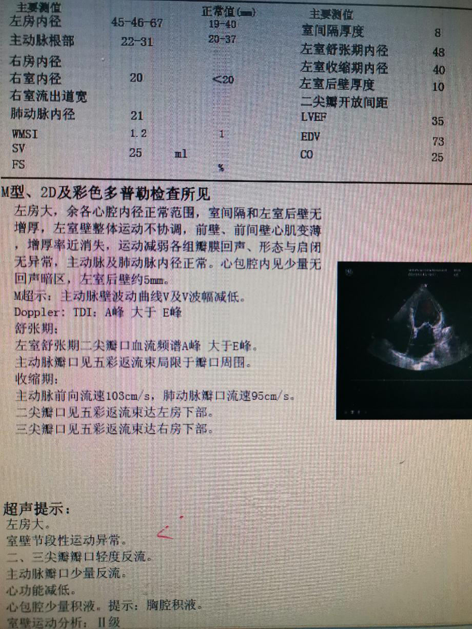 18 次/分  血压 115/72 mmhg 颈动脉搏动正常,颈静脉无怒张,肝颈静脉