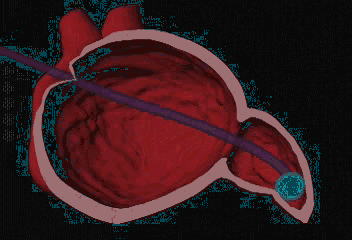 3.gif