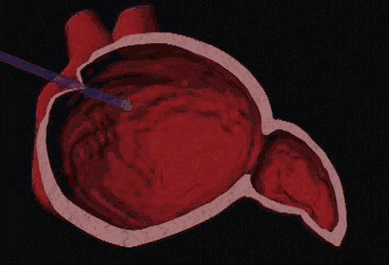 2.gif