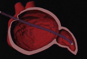33.gif