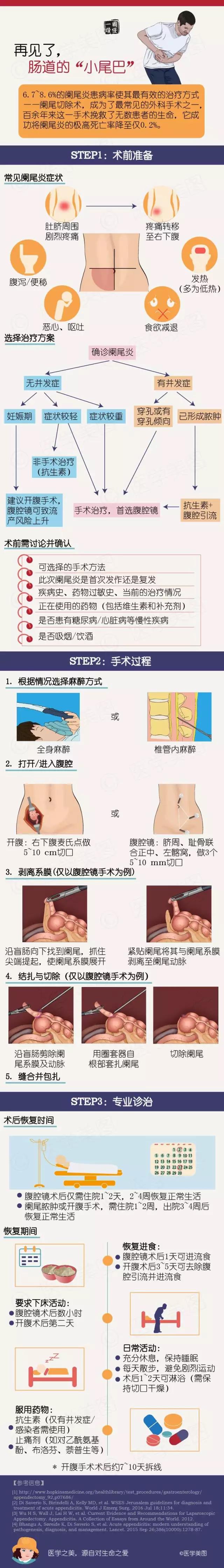 阑尾炎.jpg