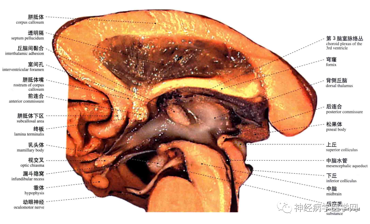 【推荐】高清大脑断层解剖,脑干及核团分步走形特点