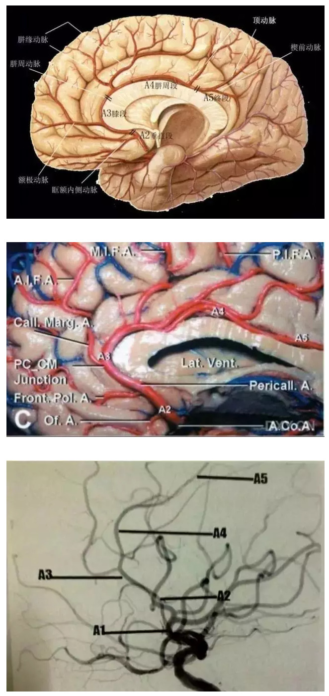 大脑前动脉分段图解