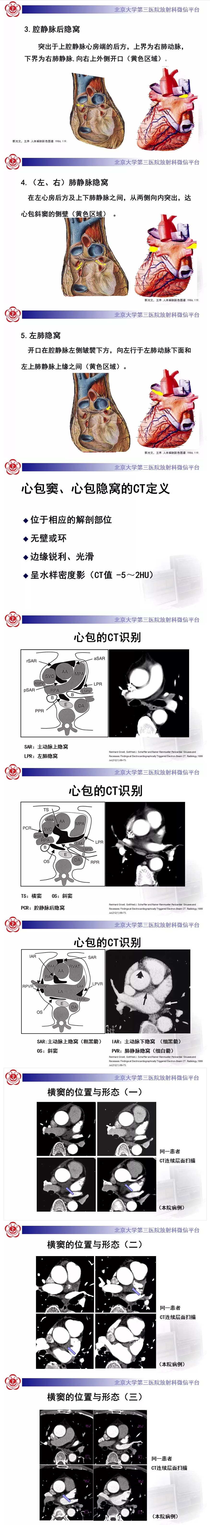 壹生资讯-心包窦及心包隐窝的解剖结构(内附ct断层图解,值得一看!