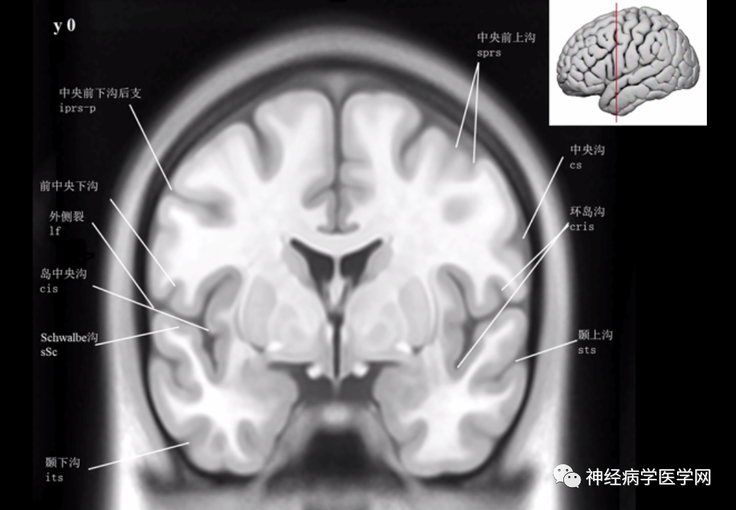 目前为止最为详尽的大脑沟回的标记图谱