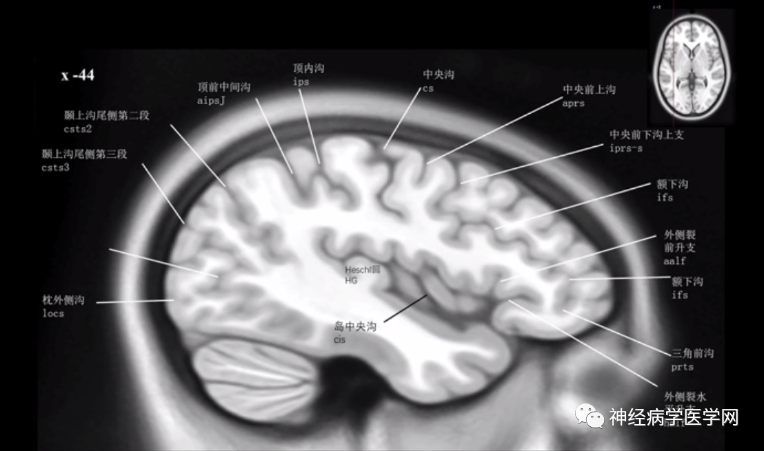 目前为止最为详尽的大脑沟回的标记图谱