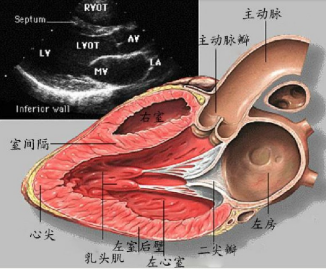 完整的切面需要能看到:左心房,左心室,二尖瓣,主动脉瓣,主动脉根部,右