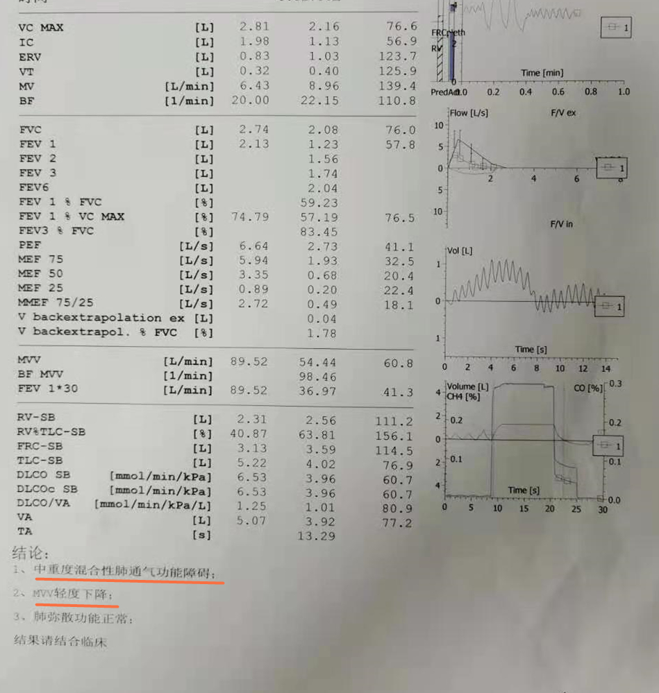 肺功能检查报告单