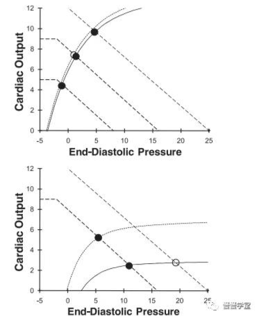 表示心排血量,可以在同一坐标图上描绘出心功能曲线和静脉回流曲线