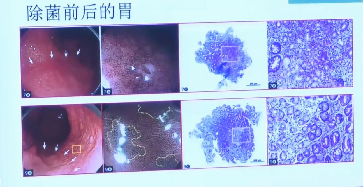 微信截图_20180401224142.png