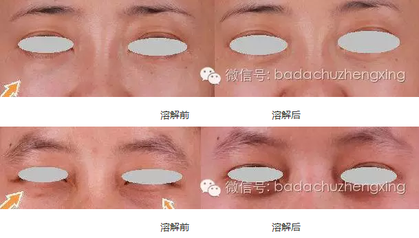 搜狗截图18年03月06日1145_8.png