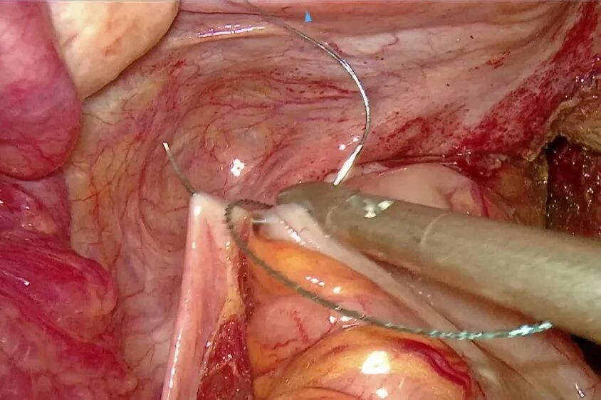 640?wx_fmt=jpeg&from=appmsg