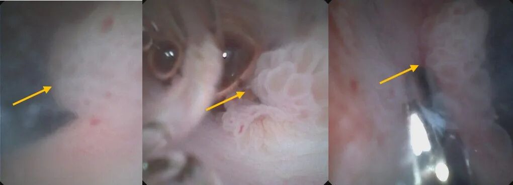 640?wx_fmt=jpeg&from=appmsg