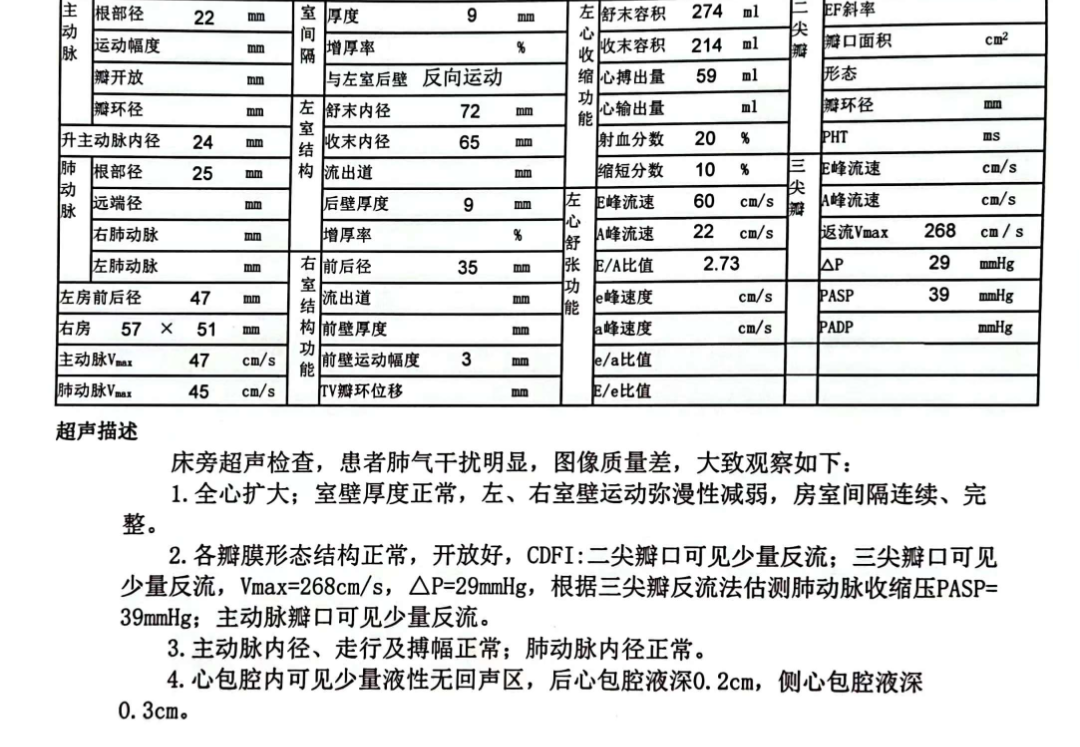 心脏彩超.png