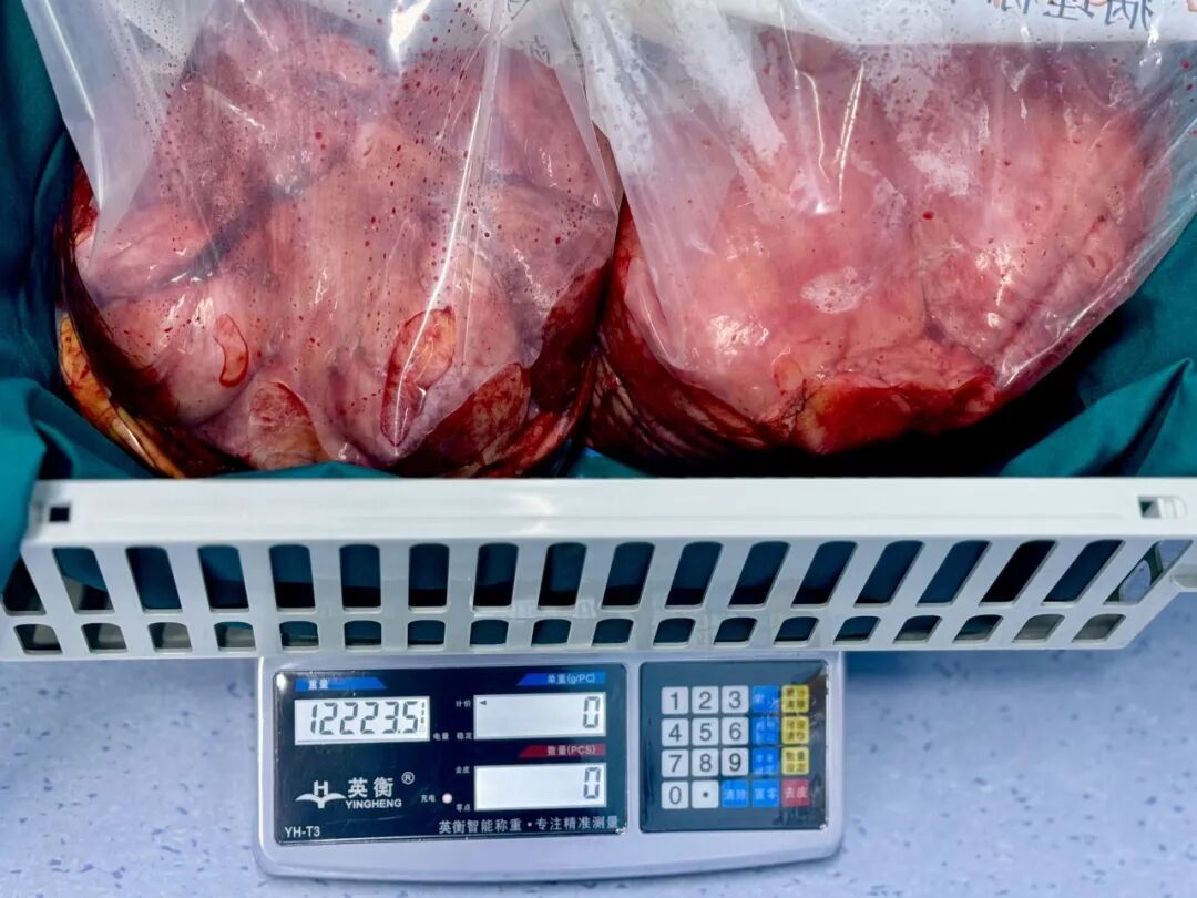 640?wx_fmt=jpeg&from=appmsg