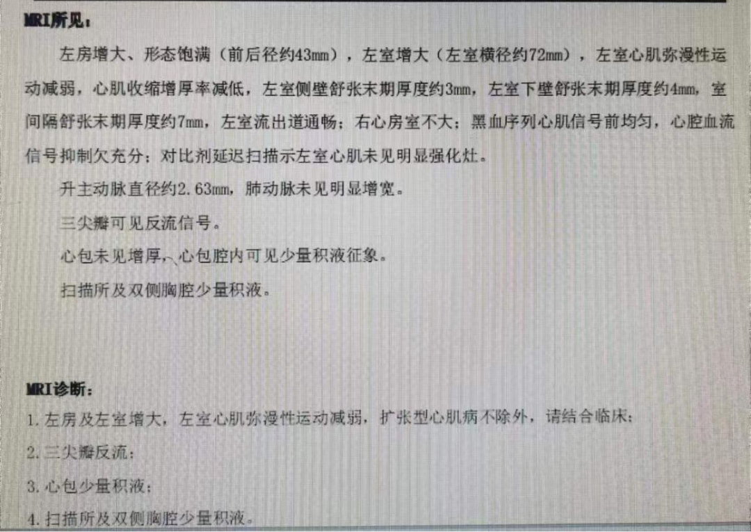 心脏核磁.png