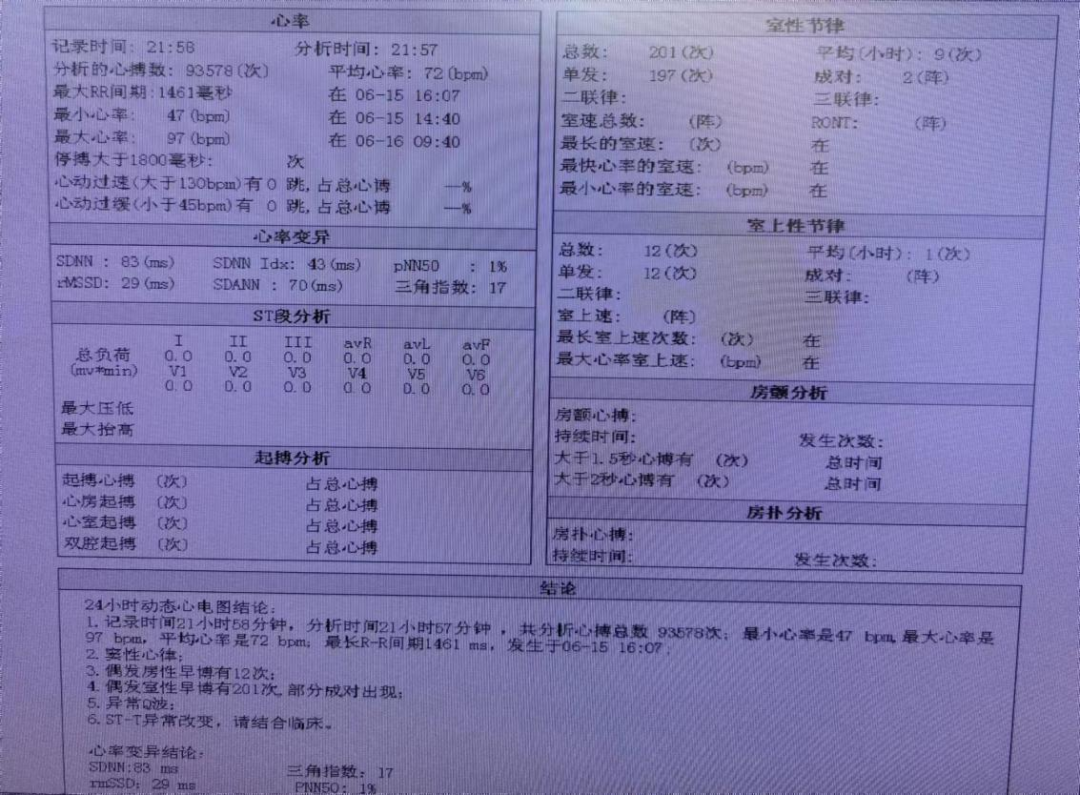 心电图.png