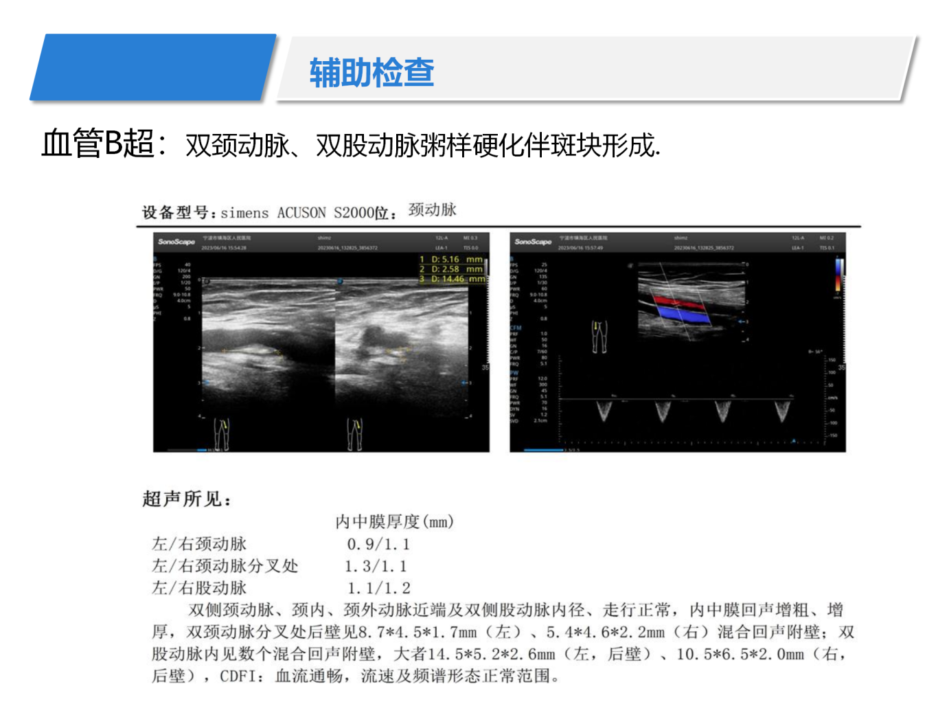 百普乐治疗高血压1例1__07.png