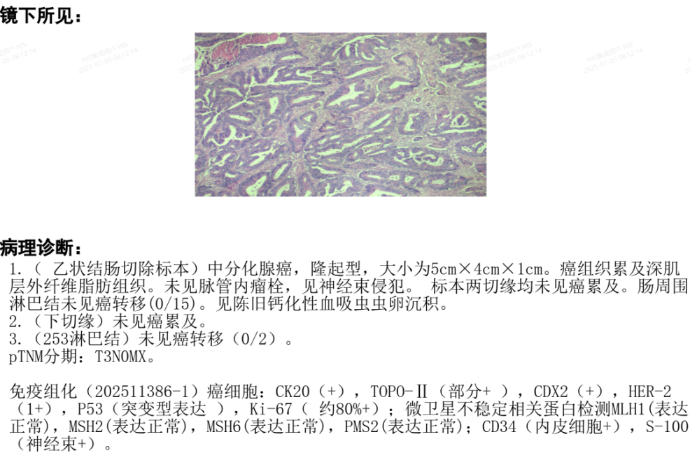 8810f8b12ce4d4dfa04fd6c6f48e0c35.png