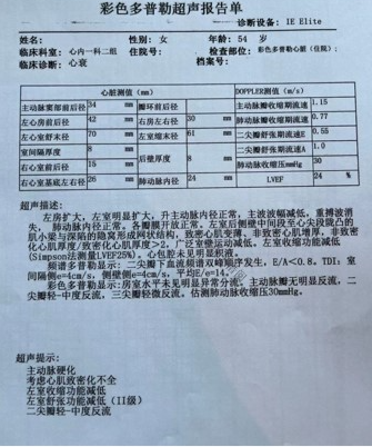 入院心脏超声.jpg