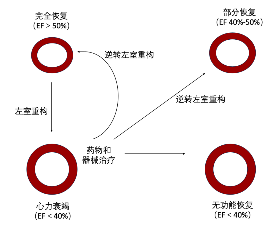 左室重构.png