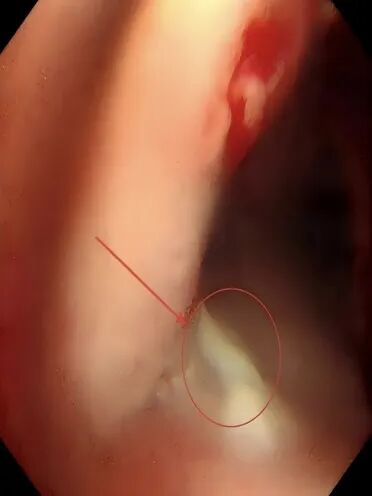 640?wx_fmt=jpeg&from=appmsg