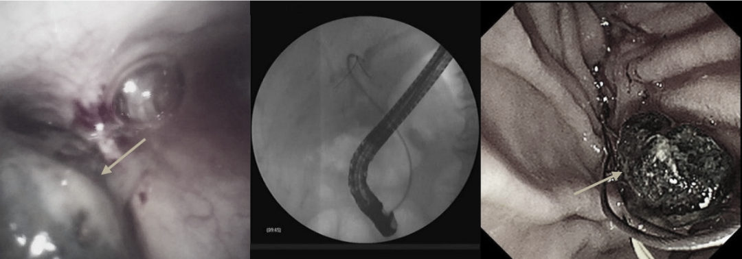 640?wx_fmt=png&from=appmsg