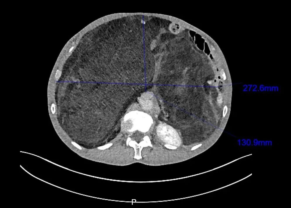 640?wx_fmt=jpeg&from=appmsg