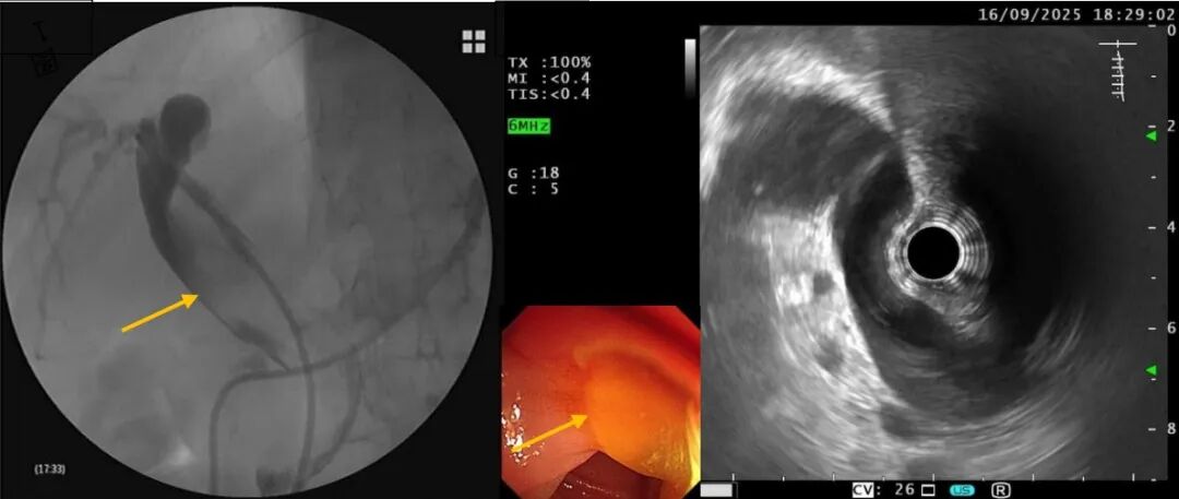 640?wx_fmt=jpeg&from=appmsg