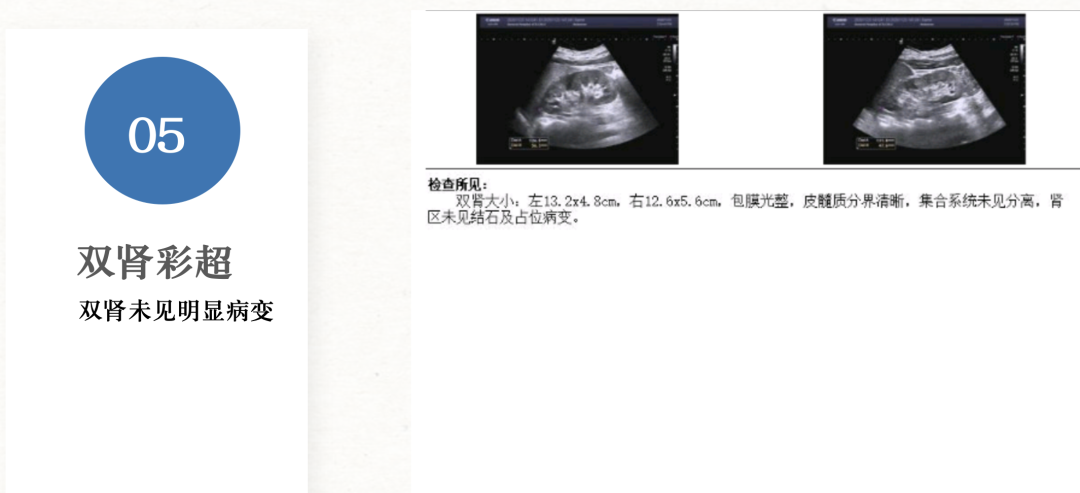 截屏2023-02-01 13.02.50.png