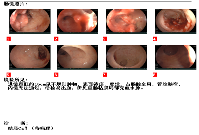 d3de9194391f65ccf535a1b23c1c1e68.png