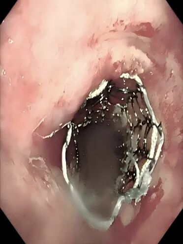 640?wx_fmt=jpeg&from=appmsg