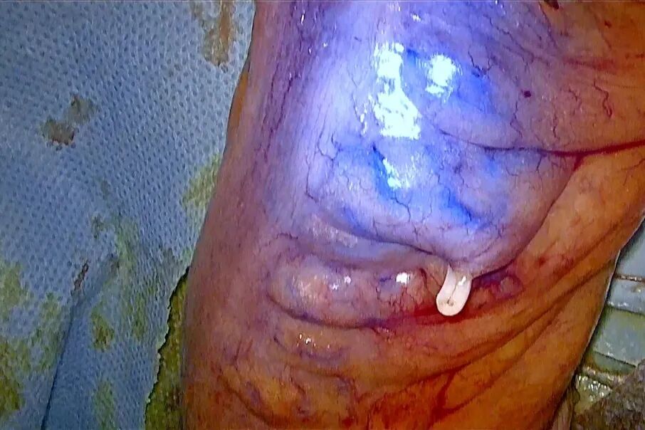 640?wx_fmt=jpeg&from=appmsg