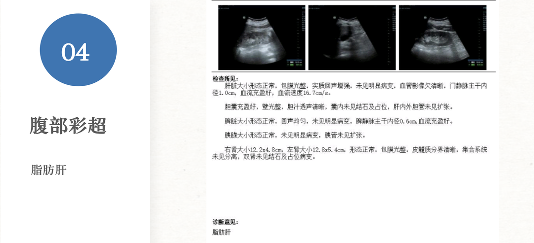截屏2023-02-01 13.02.01.png