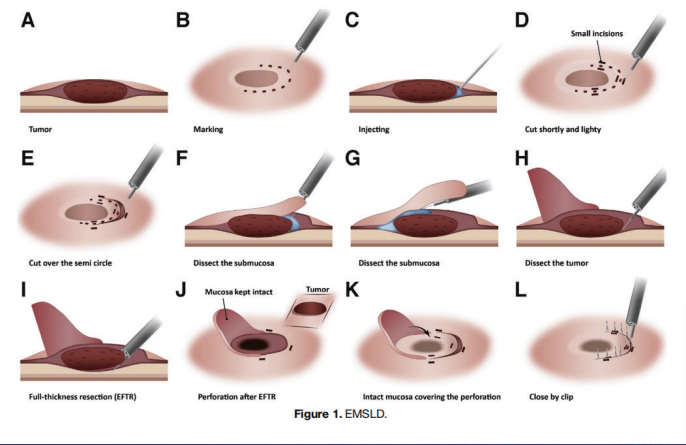 tu2.png