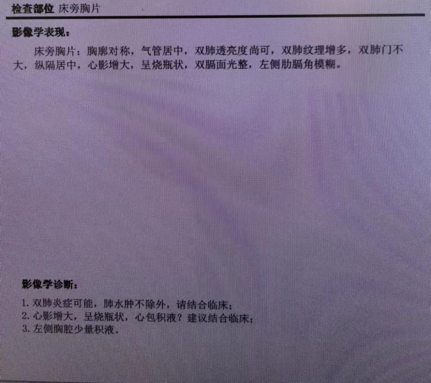 胸片.png