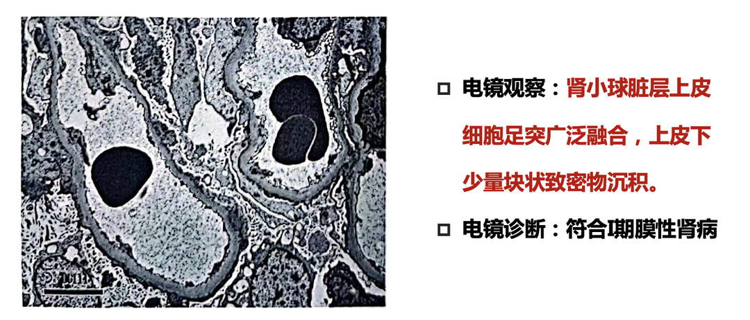 截屏2023-02-01 10.45.23.png