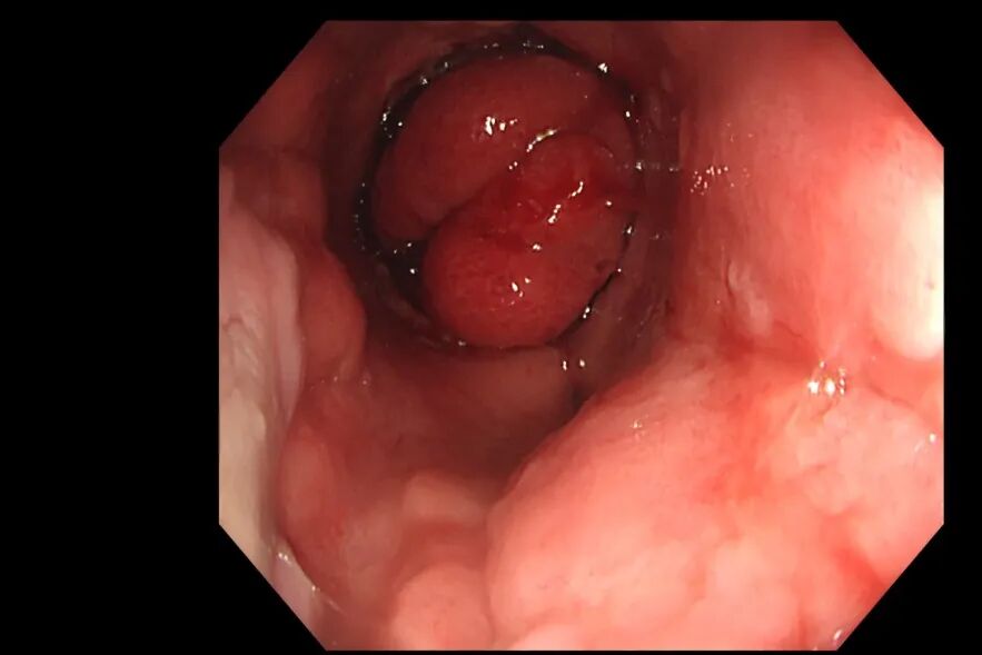 640?wx_fmt=jpeg&from=appmsg