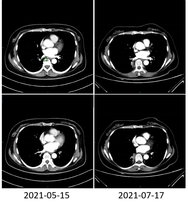 胸腹部影像学.png