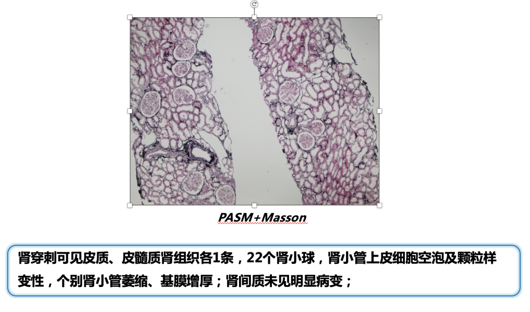 截屏2023-02-01 10.38.51.png