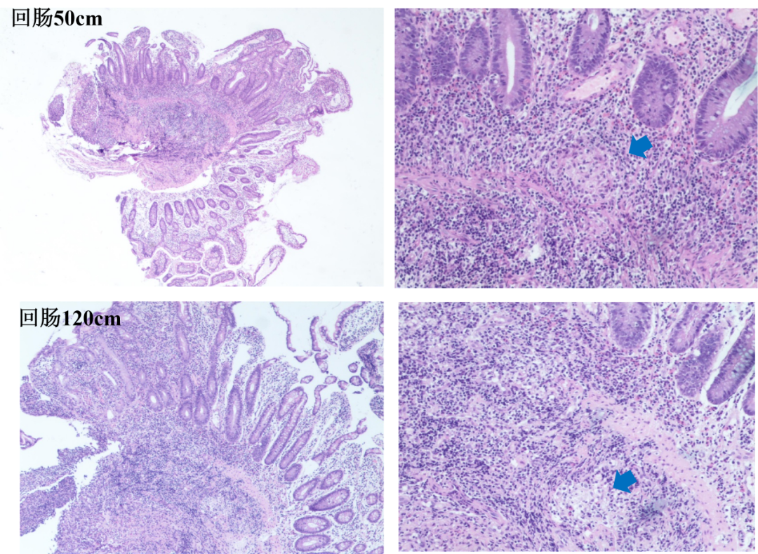 5.1306.png
