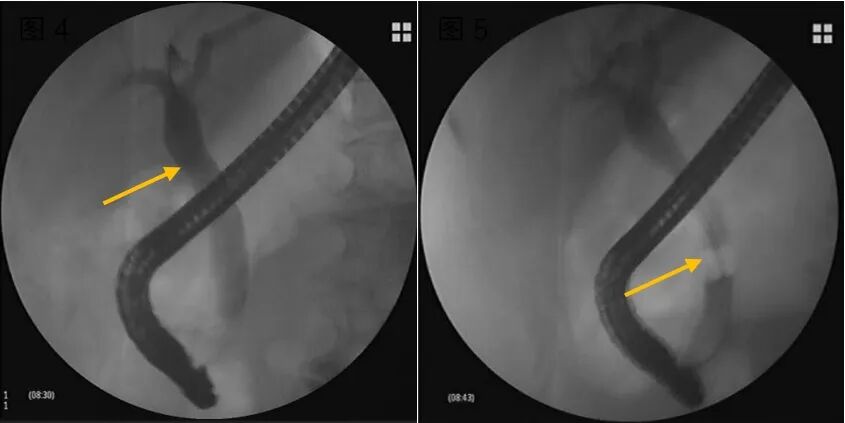 640?wx_fmt=jpeg&from=appmsg