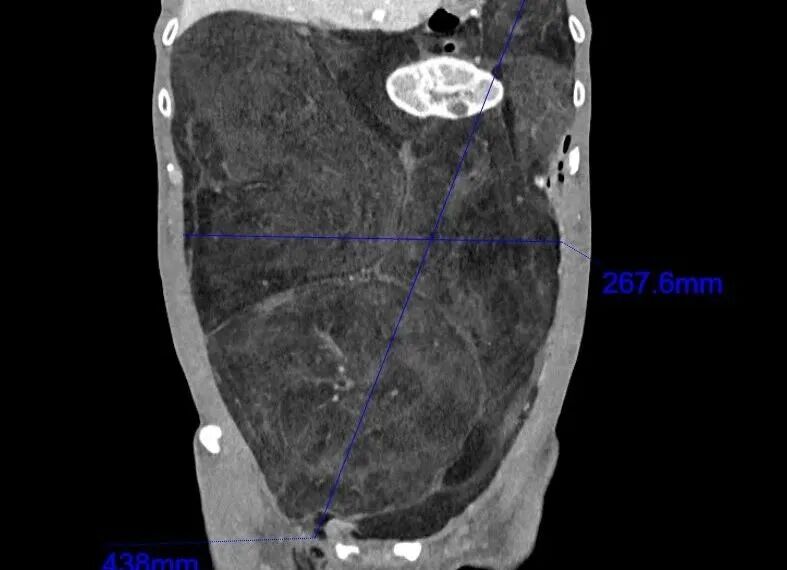 640?wx_fmt=jpeg&from=appmsg