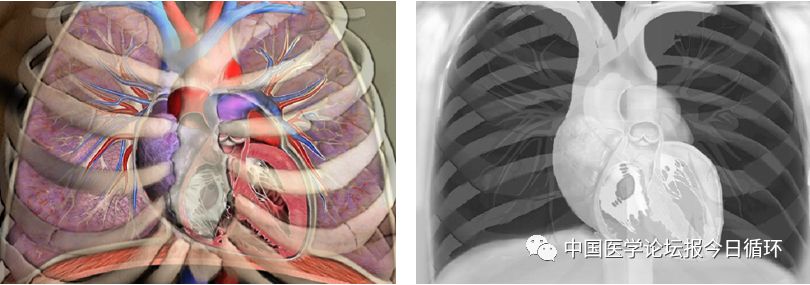 精美解剖图谱这样看心脏没理由看不懂