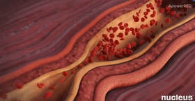 循环血流动态图图片
