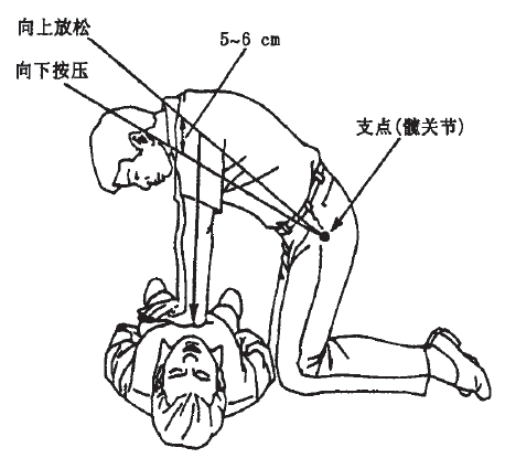 心肺复苏示意图.png