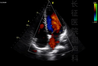 微信图片_20220425101420.gif