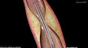7.gif